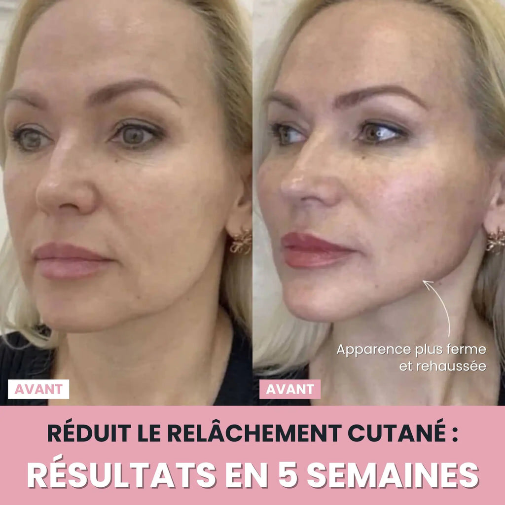 Sculptia™ : Sculpteur facial LED 7 en 1
