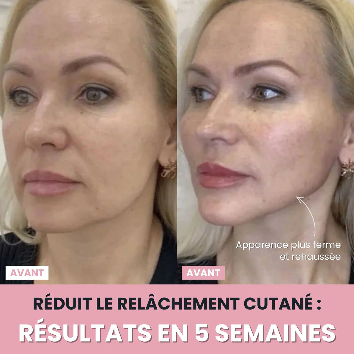 Sculptia™ : Sculpteur facial LED 7 en 1
