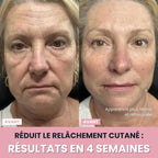 Sculptia™ : Sculpteur facial LED 7 en 1
