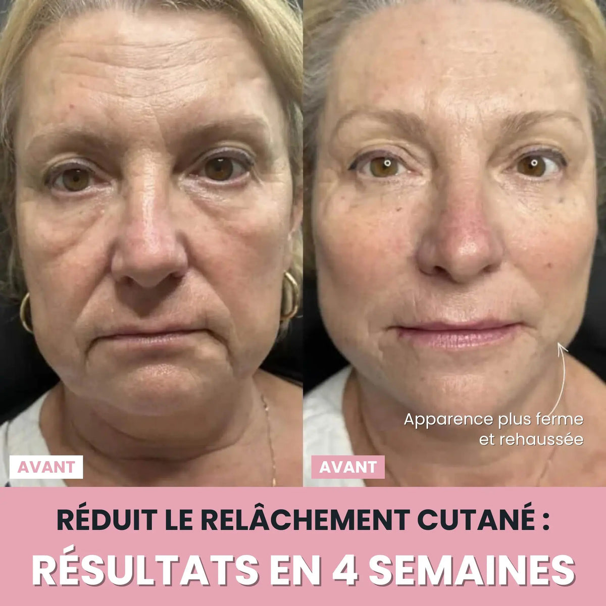 Sculptia™ : Sculpteur facial LED 7 en 1