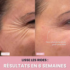 Sculptia™ : Sculpteur facial LED 7 en 1