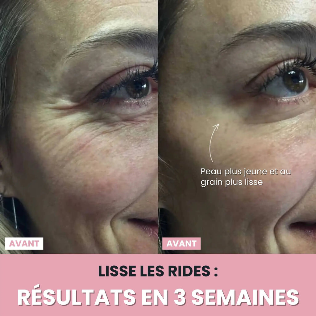 Sculptia™ : Sculpteur facial LED 7 en 1