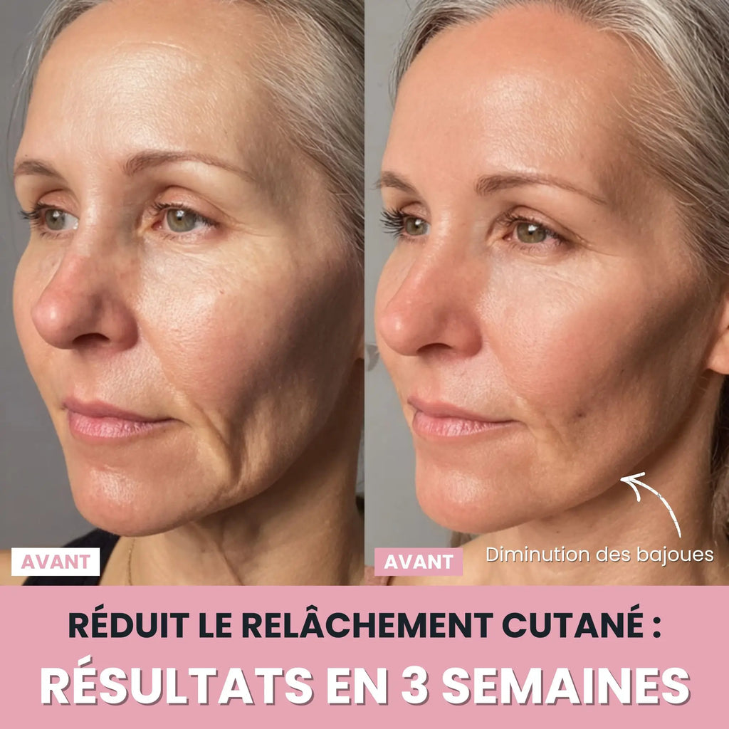 Sculptia™ : Sculpteur facial LED 7 en 1