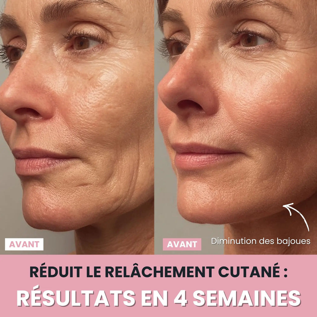 Sculptia™ : Sculpteur facial LED 7 en 1