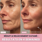 Sculptia™ : Sculpteur facial LED 7 en 1