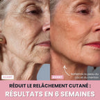 Sculptia™ : Sculpteur facial LED 7 en 1