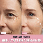 Sculptia™ : Sculpteur facial LED 7 en 1