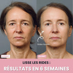 Sculptia™ : Sculpteur facial LED 7 en 1