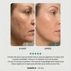 EpilSmooth Pro - Épilateur visage