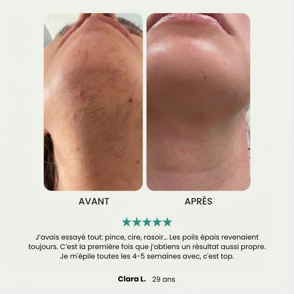 EpilSmooth Pro - Épilateur visage