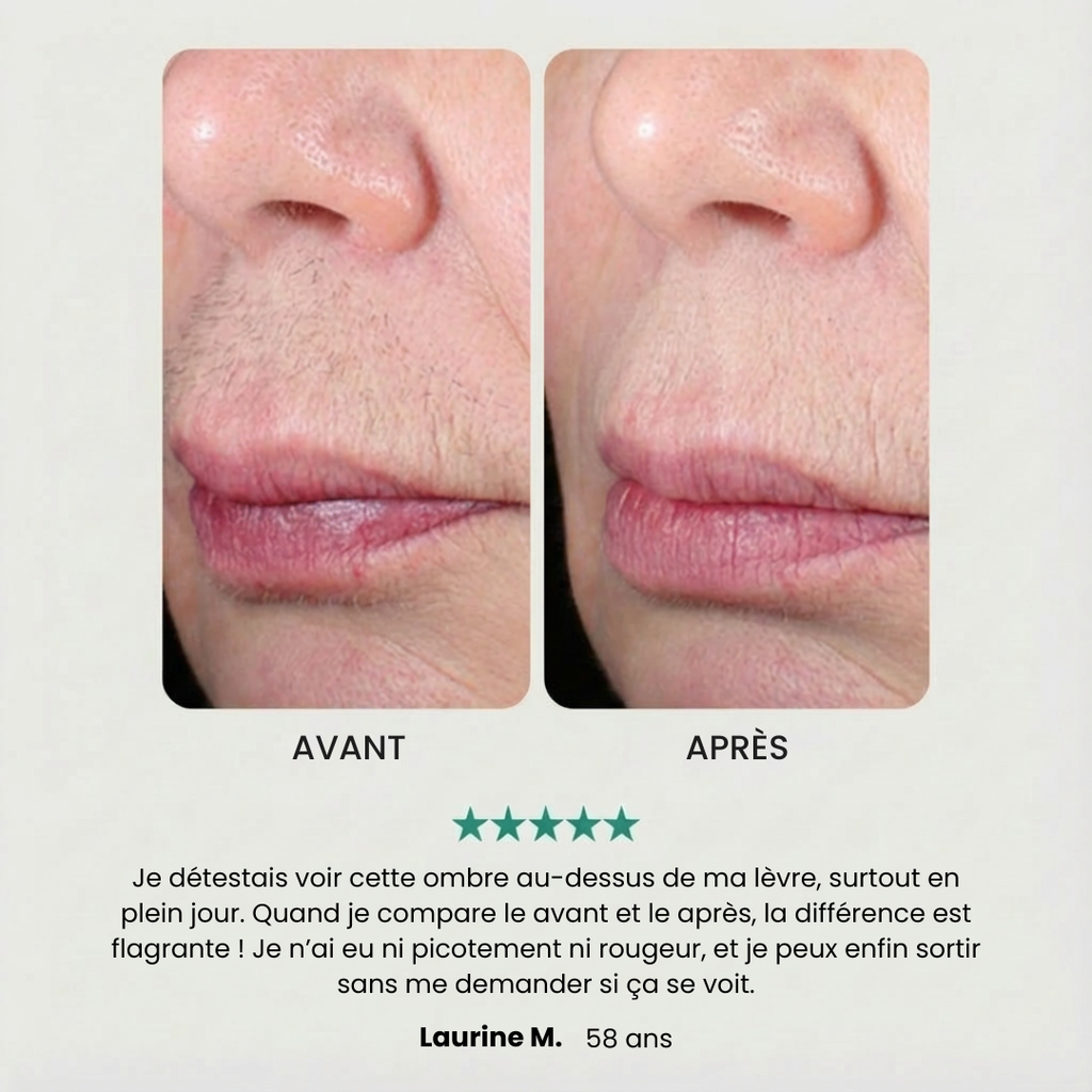 EpilSmooth Pro - Épilateur visage